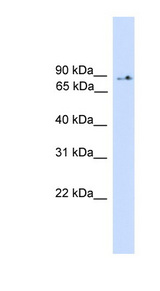 PIK3R5 antibody LS-C117128 Western blot of 293T cell lysate.