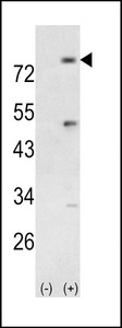 Western blot of PIK3R5 (arrow) using rabbit polyclonal PIK3R5 Antibody. 293 cell lysates (2 ug/lane) either nontransfected (Lane 1) or transiently transfected with the PIK3R5 gene (Lane 2).