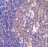 PIK3R5 Antibody immunohistochemistry of formalin-fixed and paraffin-embedded human tonsil tissue followed by peroxidase-conjugated secondary antibody and DAB staining.