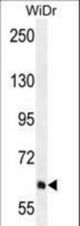 PIK3R5 Antibody western blot of WiDr cell line lysates (35 ug/lane). The PIK3R5 antibody detected the PIK3R5 protein (arrow).