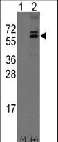 Western blot of Noelin-1(Olfm1) (arrow) using rabbit polyclonal Noelin-1(Olfm1) Antibody. 293 cell lysates (2 ug/lane) either nontransfected (Lane 1) or transiently transfected with the Noelin-1(Olfm1) gene (Lane 2) (Origene Technologies).