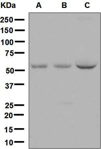 Western blot analysis on (A) fetal brain, (B) human hypothalamus, and (C) human plasma lysates using anti-OLFM1 antibody.