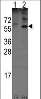 Western blot of Noelin-1(Olfm1) (arrow) using rabbit polyclonal Noelin-1(Olfm1) Antibody. 293 cell lysates (2 ug/lane) either nontransfected (Lane 1) or transiently transfected with the Noelin-1(Olfm1) gene (Lane 2) (Origene Technologies).