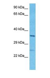 Western blot of PITX3 Antibody with human NCI-H226 Whole Cell lysate.