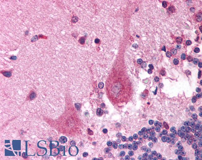 Anti-PITX3 antibody IHC of human brain, cerebellum. Immunohistochemistry of formalin-fixed, paraffin-embedded tissue after heat-induced antigen retrieval. Antibody LS-B994 concentration 5 ug/ml.