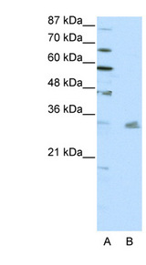 PITX3 antibody LS-B994 Western blot of HepG2 cell lysate.