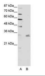A: Marker, B: HepG2 Cell Lysate