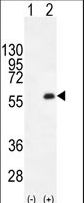 Western blot of PKMYT1 (arrow) using rabbit polyclonal PKMYT1 C-term. 293 cell lysates (2 ug/lane) either nontransfected (Lane 1) or transiently transfected (Lane 2) with the PKMYT1 gene.