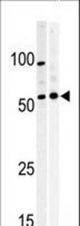 Western blot of anti-PKMYT1 Pabin A375(left) and Y79 (right)cell line lysate. PKMYT1(arrow) was detected using the purified antibody.