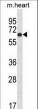 Western blot of Pkmyt1 (arrow) using rabbit polyclonal Mouse Pkmyt1 Antibody. 293 cell lysates (2 ug/lane) either nontransfected (Lane 1) or transiently transfected (Lane 2) with the Pkmyt1 gene.