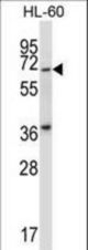 Mouse Pkmyt1 Antibody western blot of HL-60 cell line lysates (35 ug/lane). The Pkmyt1 antibody detected the Pkmyt1 protein (arrow).