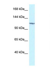 PKN2 antibody LS-C145330 Western blot of 293T Cell lysate. Antibody concentration 1 ug/ml.
