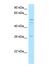 C11orf42 antibody LS-C146037 Western blot of MCF7 Cell lysate. Antibody concentration 1 ug/ml. This image was taken for the base form of this product. Alternate forms, such as conjugated, azide-free, or ready-to-use, have not been tested.