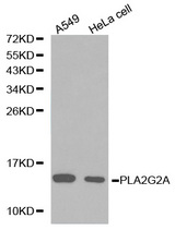 Western blot analysis of A549 cell and HeLa cell lysate using PLA2G2A antibody.