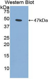 Western blot of recombinant SPLA2 / PLA2.