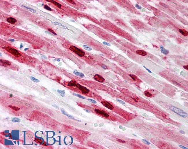 Anti-PLA2G2A antibody IHC of human heart. Immunohistochemistry of formalin-fixed, paraffin-embedded tissue after heat-induced antigen retrieval. Antibody LS-B1614 concentration 5 ug/ml.