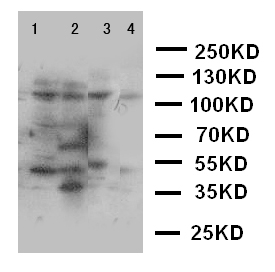 WB of PLA2G4 / PLA2G4A antibody. Lane 1: Rat Testis Tissue Lysate. Lane 2: Rat Brain Tissue Lysate. Lane 3: A549 Cell Lysate. Lane 4: COLO320 Cell Lysate..