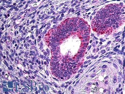 Anti-PLA2G4A antibody IHC of human uterus. Immunohistochemistry of formalin-fixed, paraffin-embedded tissue after heat-induced antigen retrieval. Antibody LS-B5952 concentration 3.75 ug/ml.
