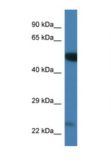 PLK3 antibody LS-C135264 Western blot of Mouse Brain lysate. Antibody concentration 1 ug/ml.
