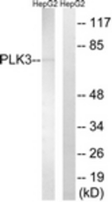 Western blot of extracts from HepG2 cells, using PLK3 Antibody. The lane on the right is treated with the synthesized peptide.