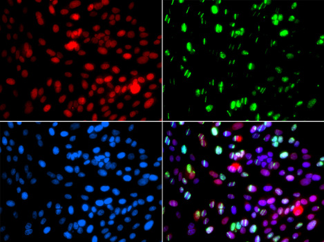 Immunofluorescence blot of GFP-RNF168 transgenic U2OS cell using POLD3 antibody. Green: GFP-RNF168 fusion protein expression for DNA damage marker. Blue: DAPI for nuclear staining. RNF168(GFP) can be used to mark cells damaged by UV-A laser as they always gather around DNA damage region.