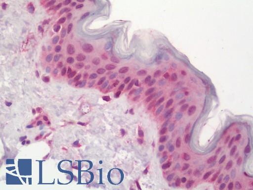 Human Skin: Formalin-Fixed, Paraffin-Embedded (FFPE)
