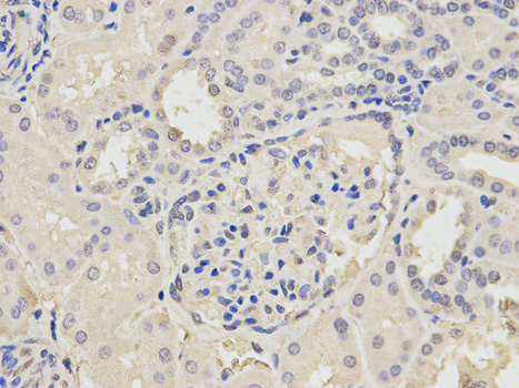 Immunohistochemistry of paraffin-embedded rat brain using POLH antibody at dilution of 1:200 (400x lens).