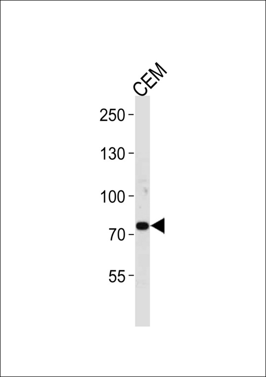 POLH Antibody western blot of CEM cell lysate (35 ug/lane). This demonstrates that the POLH antibody detected the POLH protein (arrow).