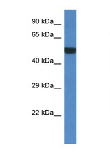 PORCN antibody LS-C145383 Western blot of Mouse Thymus lysate. Antibody concentration 1 ug/ml.