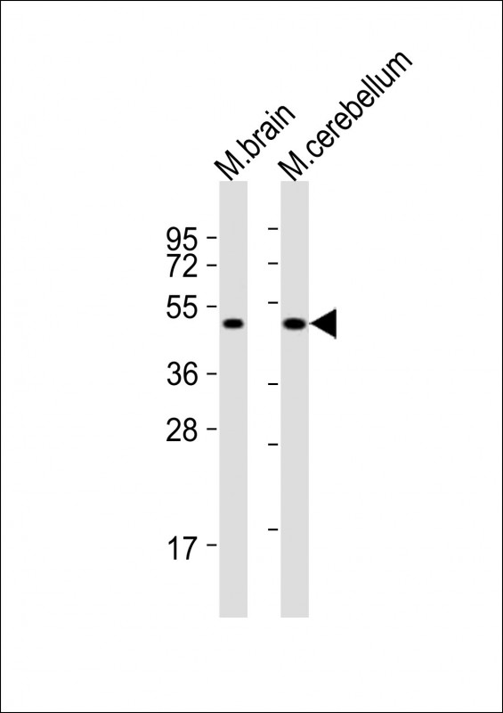 All lanes : Anti-PORCN Antibody at 1:2000 dilution Lane 1: mouse brain lysates Lane 2: mouse cerebellum lysates Lysates/proteins at 20 ug per lane. Secondary Goat Anti-Rabbit IgG, (H+L), Peroxidase conjugated at 1/10000 dilution Predicted band size : 52 kDa Blocking/Dilution buffer: 5% NFDM/TBST.