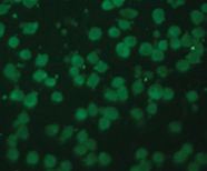 Immunofluorescent staining of HeLa cells with PORCN antibody (10 ug/ml)