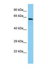 Western blot of Human HepG2. POTEB antibody dilution 1.0 ug/ml.