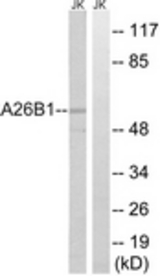 Western blot of extracts from Jurkat cells, using A26B1 Antibody. The lane on the right was incubated with synthetic peptide.