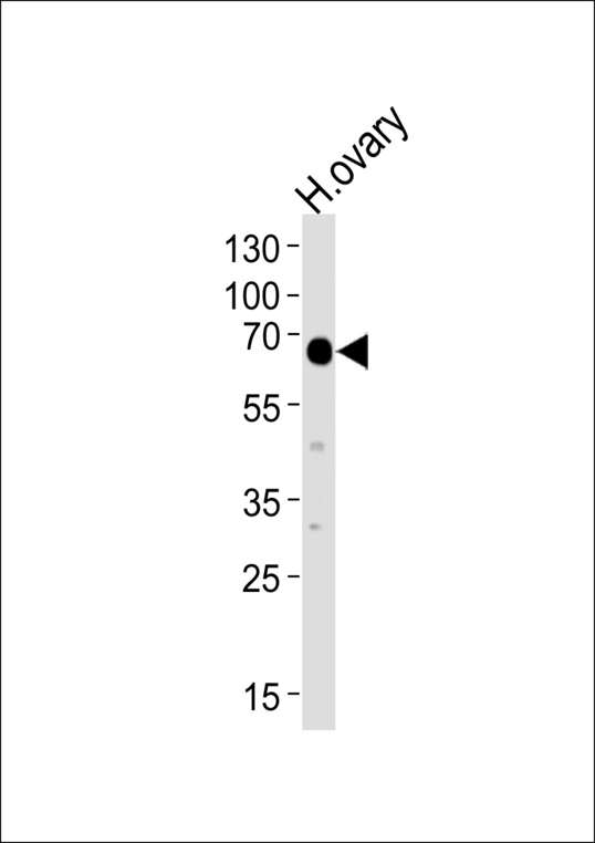 Western blot of lysate from human ovary tissue lysate, using POTEB Antibody. Antibody was diluted at 1:1000 at each lane. A goat anti-rabbit IgG H&L (HRP) at 1:5000 dilution was used as the secondary antibody. Lysate at 35ug per lane.