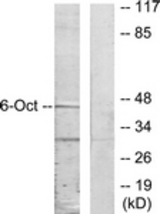 Western blot of extracts from A549 cells, using OCT6 Antibody. The lane on the right is treated with the synthesized peptide.