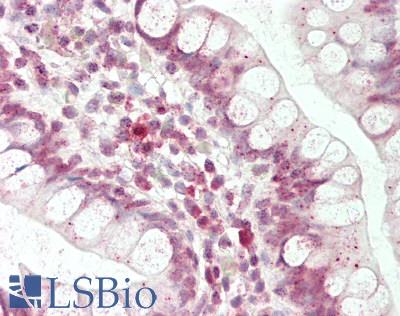 Human Small Intestine: Formalin-Fixed, Paraffin-Embedded (FFPE)