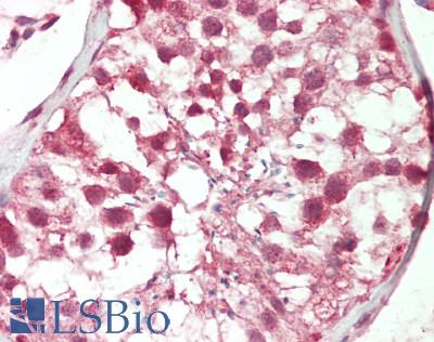 Human Testis: Formalin-Fixed, Paraffin-Embedded (FFPE)
