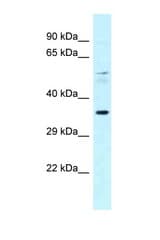 PPARA / PPAR antibody LS-C145851 Western blot of Rat Brain lysate. Antibody concentration 1 ug/ml.