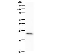 Western blot analysis of immunized recombinant protein, using anti-PPARA monoclonal antibody.