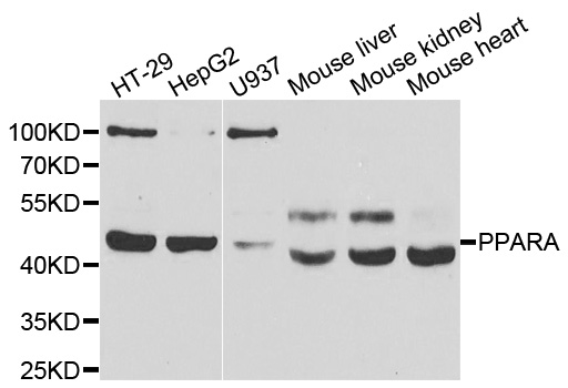 Western blot analysis of extracts of various cell lines, using PPARA antibody.