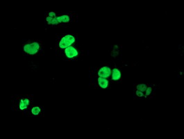 Anti-PPARA mouse monoclonal antibody immunofluorescent staining of COS7 cells transiently transfected by pCMV6-ENTRY PPARA.