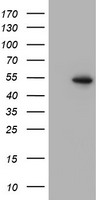 HEK293T cells were transfected with the pCMV6-ENTRY control (Left lane) or pCMV6-ENTRY PPARA (Right lane) cDNA for 48 hrs and lysed. Equivalent amounts of cell lysates (5 ug per lane) were separated by SDS-PAGE and immunoblotted with anti-PPARA.