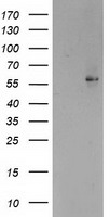 HEK293T cells were transfected with the pCMV6-ENTRY control (Left lane) or pCMV6-ENTRY PPARA (Right lane) cDNA for 48 hrs and lysed. Equivalent amounts of cell lysates (5 ug per lane) were separated by SDS-PAGE and immunoblotted with anti-PPARA.