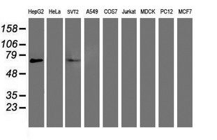 Western blot of extracts (35ug) from 9 different cell lines by using anti-PPARA monoclonal antibody.