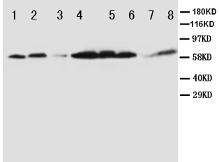 WB of PPAR Alpha antibody. Lane 1: Rat Liver Tissue Lysate. Lane 2: Rat Brain Tissue Lysate. Lane 3: Rat Cardiac Muscle Tissue Lysate. Lane 4: MM231 Cell Lysate. Lane 5: HELA Cell Lysate. Lane 6: SMMC Cell Lysate. Lane 7: HT1080 Cell Lysate. Lane 8: SW620 Cell Lysate.
