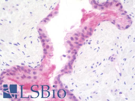 Human Prostate: Formalin-Fixed, Paraffin-Embedded (FFPE)