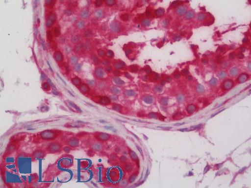 Human Testis: Formalin-Fixed, Paraffin-Embedded (FFPE)