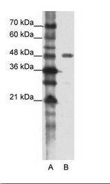 A: Marker, B: HepG2 Cell Lysate