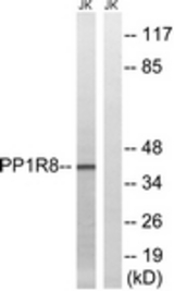 Western blot of extracts from Jurkat cells, using PPP1R8 Antibody. The lane on the right is treated with the synthesized peptide.