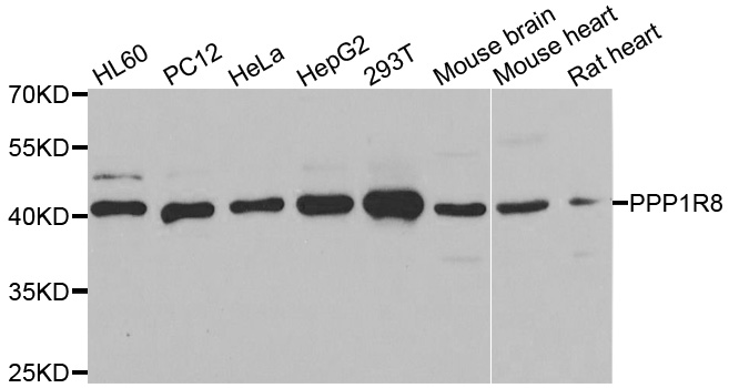 Western blot analysis of extracts of various cell lines, using PPP1R8 antibody.